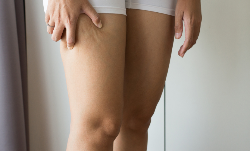 膝上の肉を落とす方法とその原因とは プロが徹底解説 Keysbit